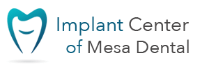 Dental Implants is the Best Method of Restoring Tooth Loss