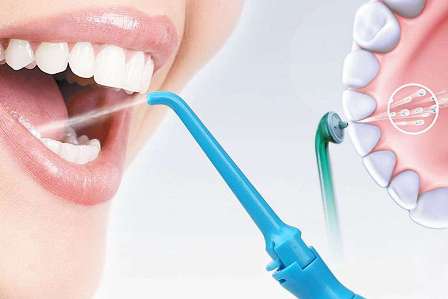 Dental Irrigator – A Hassle Free Solution To Oral Hazards