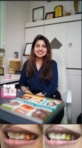 dr.-medha-pethe’s-“glaminate”-for-designer-smile